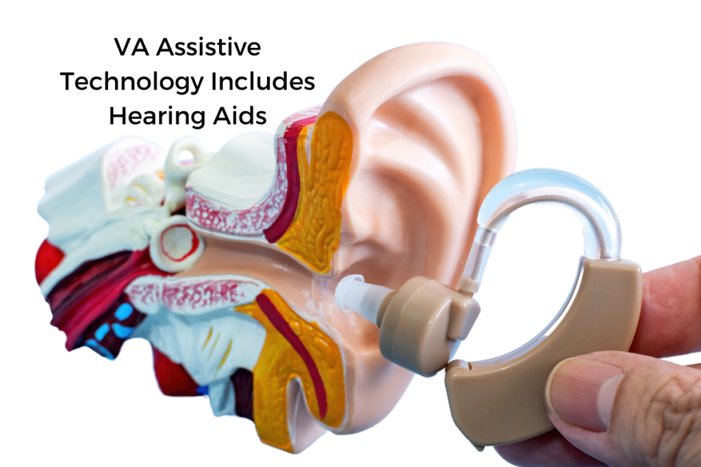 A cross-section model of a human ear with different anatomical parts colored and a hand holding a hearing aid near the model against a black background.